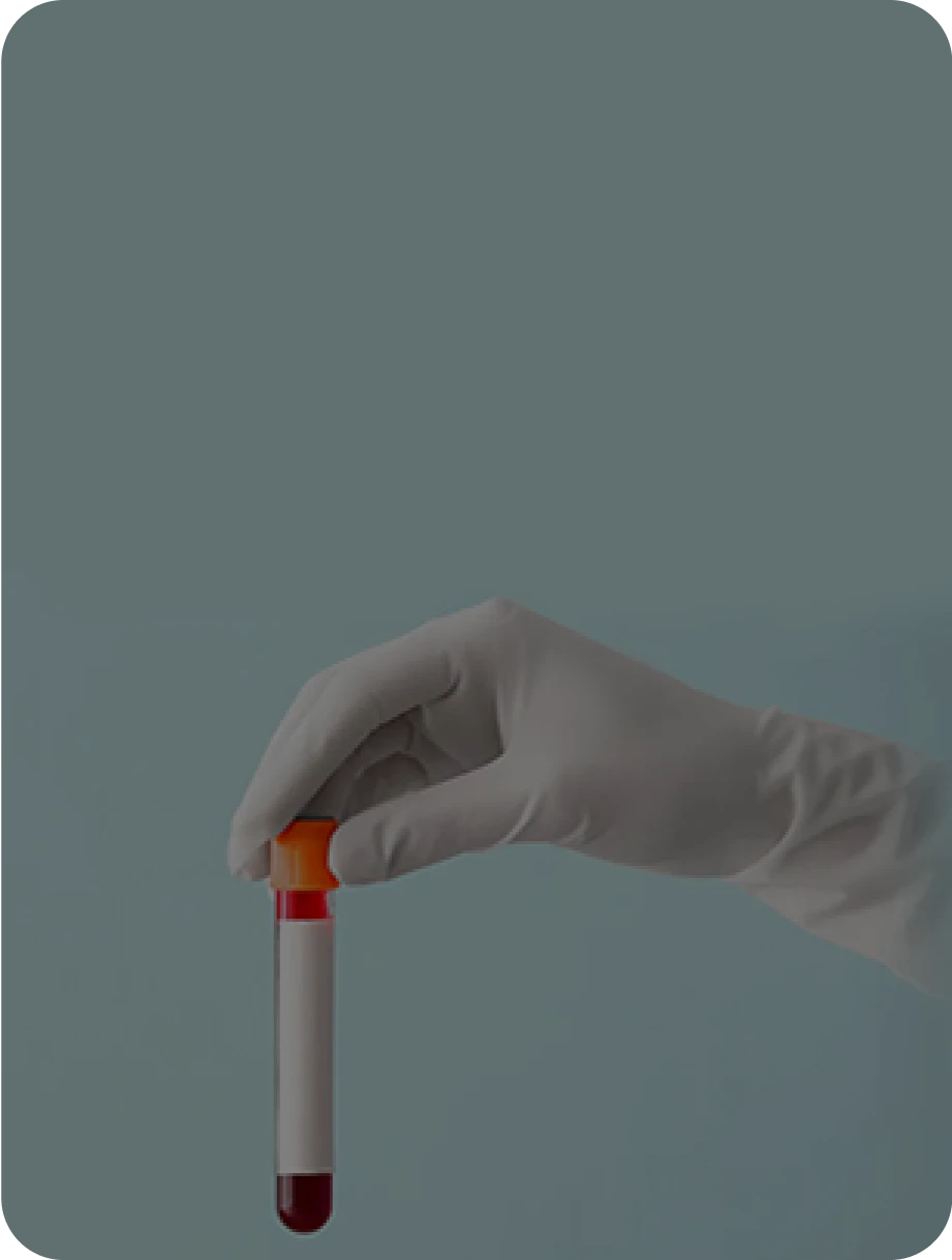 How do you decide between blood or buccal swab collection?