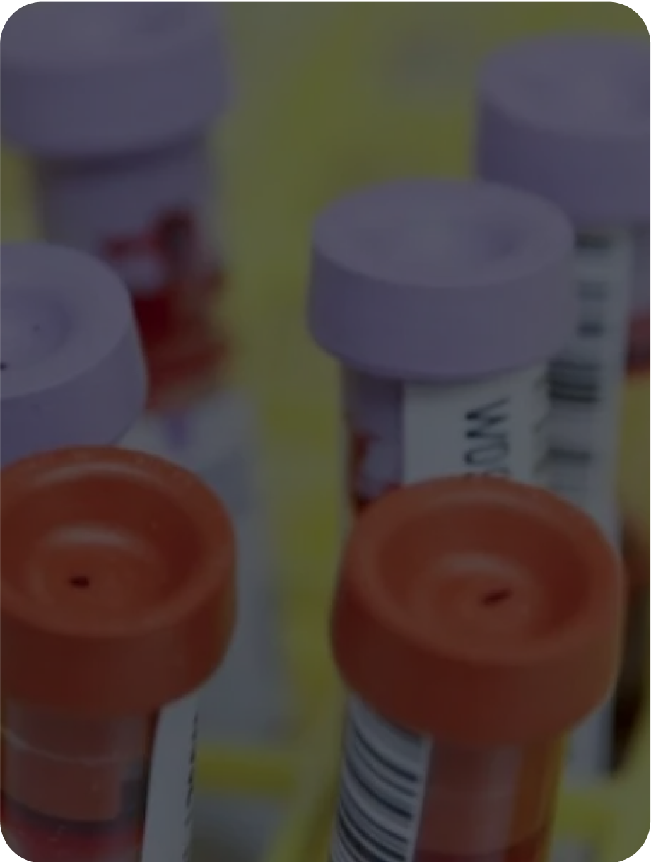 What is Genetic Screening?