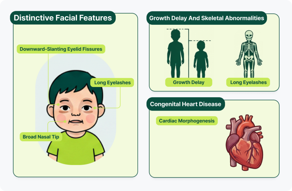 Infographic showing facial traits, growth delay, and heart disease linked to congenital syndrome.