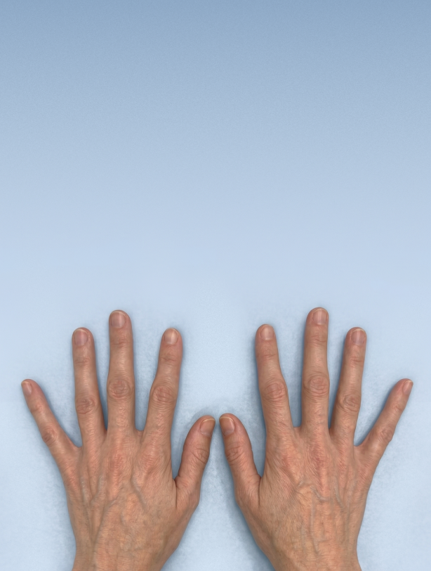 Episode 12: Marfan Syndrome — Why Does a Single FBN1 Variant Cause Systemic Disease?