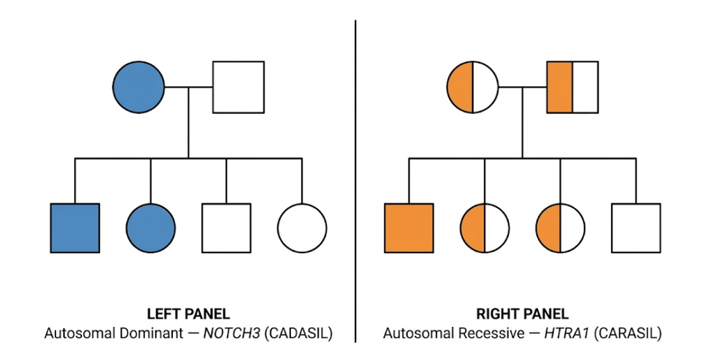 Pedigree chart contrasting autosomal dominant CADASIL and autosomal recessive CARASIL inheritance.