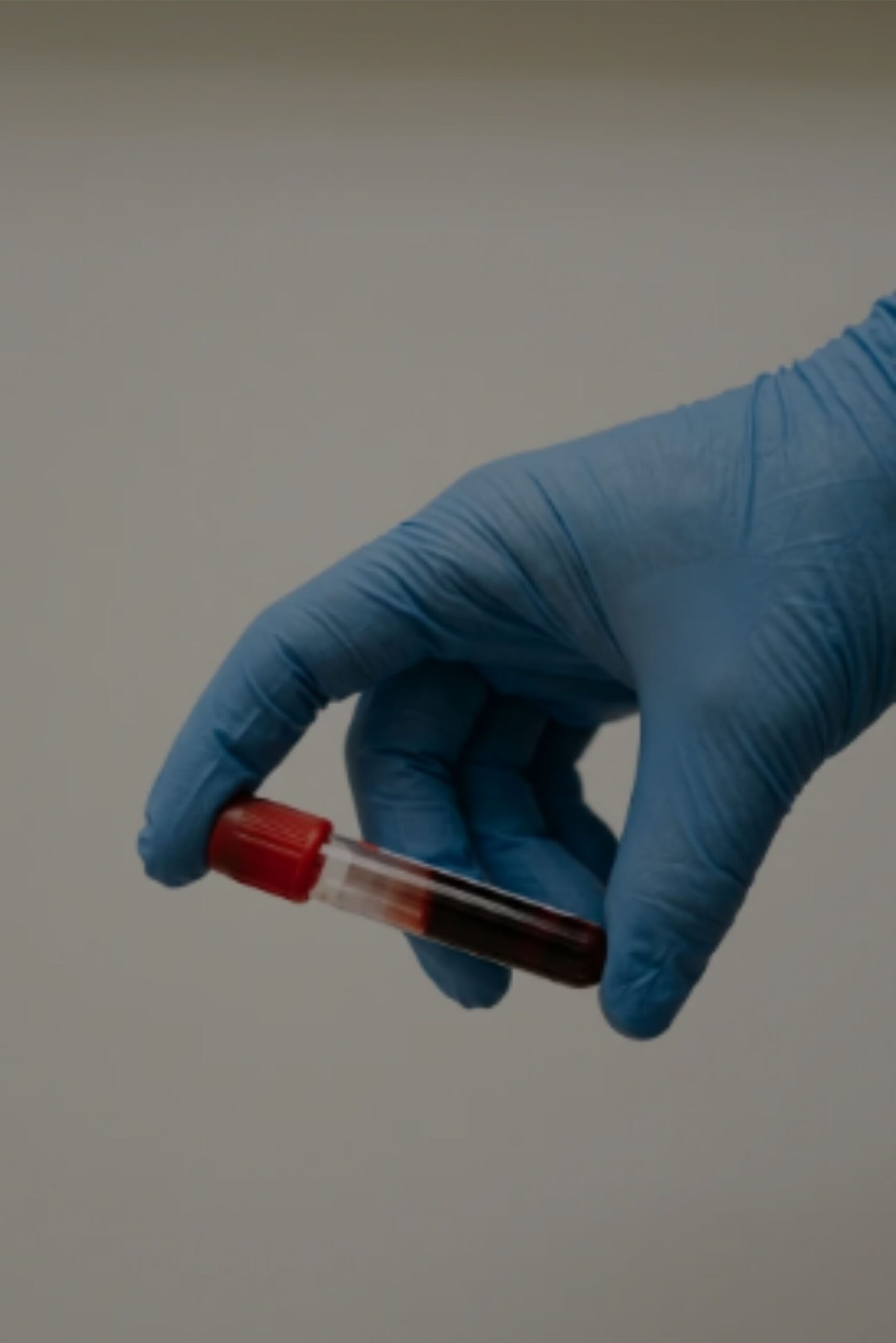 적혈구가 낫 모양으로 변한다? 겸상적혈구병(Sickle Cell Disease) 이해하기